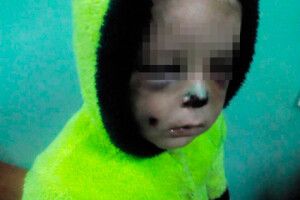На Житомирщині жінка жорстоко побила дворічного сина (фото)