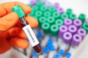 На Рівненщині підтвердили дев'ять випадків захворювання на COVID-19. Є померла. Всього захворіло 218 українців (НАЖИВО)