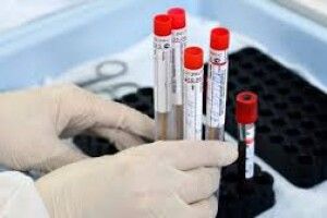 У яких селах Любешівщини хворіють на коронавірус