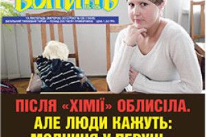 ПІСЛЯ «ХІМІЇ» ОБЛИСІЛА. А ЛЮДИ КАЖУТЬ: «МОДНИЦЯ У ПЕРУЦІ»...