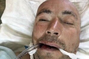 Поліція просить допомогти встановити особу чоловіка, знайденого у Рівному непритомним (фото)