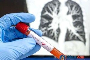 В Україні можливий жорсткий карантин. Де можна здати аналіз ПЦР на коронавірус в Луцьку