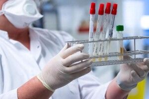 COVID-19: у передвеликодню суботу одужало більше українців, ніж захворіло