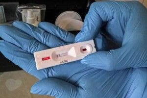 На Волині ще одна «районка» робитиме ІФА-тести на коронавірус