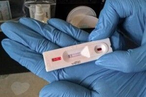 У райлікарні на Волині можна буде зробити ІФА-тест на коронавірус