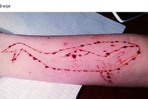 15-річна лучанка вже вирізала на руці «синього кита»…