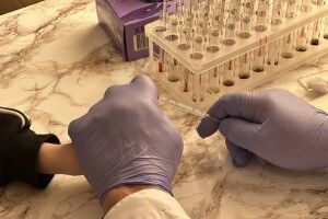 Перевірка на ВІЛ, гепатити та ЕКГ без черг: у селі на Волині медики влаштували день здоров'я