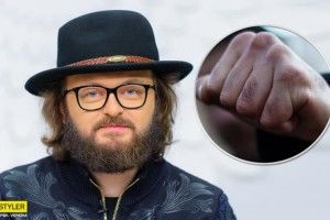 Невже не впізнали суперзірку: у Києві побили Дзідзьо! 