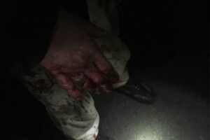 Вистежили по крові: у Луцьку 23-річний чоловік намагався обікрасти магазин (Фото)