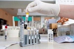 У Польщі на кір захворіли кілька заробітчан з України 