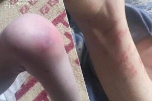 Таргани, відсутність світла та побої: на Київщині з родини вилучили трьох дітей