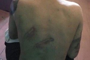 Прокуратура розслідуватиме факти жорстокого поводження з утриманими в Одеському СІЗО (фото)
