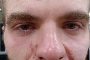 У центрі Львова жорстоко побили українського поета та вуличного музиканта (Фото)