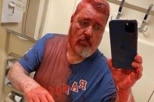У Росії напали на Нобелівського лауреата
