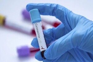Луцьк знову в лідерах по захворюванню на ковід в області