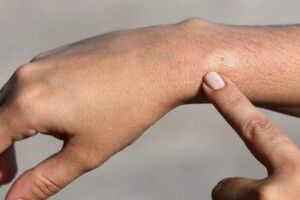 На Рівненщині мати покусала доньку