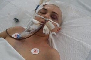 Поліція взялась розслідувати смерть волинянки, яку забив співмешканець