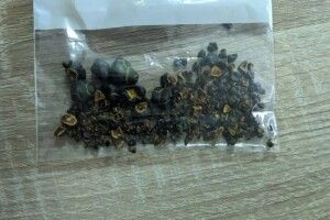 Волинські медики видалили пацієнту понад 100 великих каменів