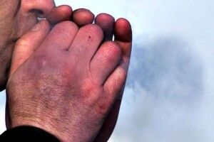 На Волині двоє людей постраждали від переохолодження