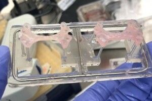 Учені винайшли «живий пластир»