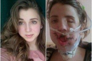 На Волині сім'я скаліченої в страшній ДТП дівчини потерпає від цькування волонтера (Фото)
