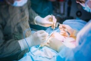 В Україні офіційно затвердили вартість пересадки органів