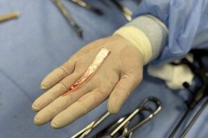 Вийшов на балкон подивитися на «шахед»: у Львові чоловік ледь не загинув через цікавість