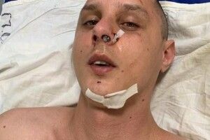 У Києві жорстоко побили автора пісень гурту KAZKA 