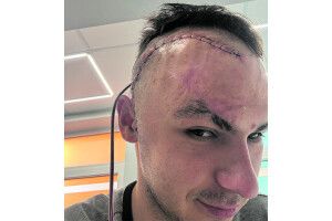 Герой з Волині: «Добре, що шолом  не застібнув, а то голову відірвало б»