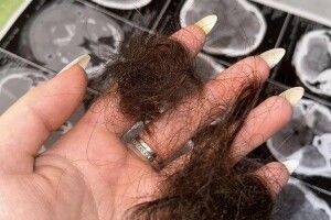 «Ти навідниця військкомату»: на Івано-Франківщині місцеві побили жінку