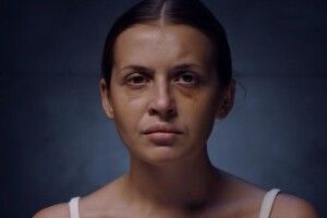У кліпі української співачки знялася дівчина, на яку напали у потязі