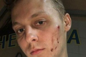 У Києві побили сина депутата Шуфрича