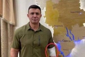 «Слуга» Тищенко із пов’язкою на руці насмішив мережу 