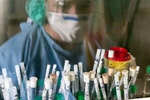 На Волині пацієнти найдовше чекають результатів аналізу на коронавірус