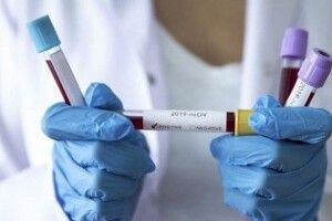 У Маневицькому районі підтвердили перший випадок коронавірусу