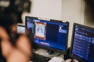 У Польщі українці зробили пересадку легенів, які «згоріли» в результаті COVID-19