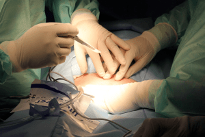 Зірка радянського кіно переніс екстрену операцію й досі перебуває у реанімації (Фото)