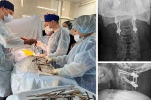 Майже 25 років ходив зі зламаним хребцем: у Рівному вперше провели операцію Хармса