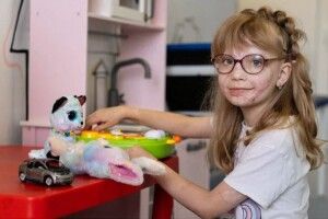«Коли я вперше побачила Аню, знепритомніла. Опіки були повсюди…»