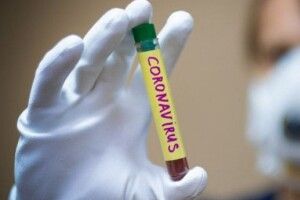 Ще семеро лучан підчепили COVID-19