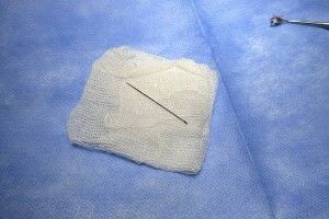 На Львівщині школярка кілька днів ходила з голкою в руці, навіть не підозрюючи про це