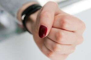 Помирити не зміг навіть староста села: на Рівненщині жінка відлупцювала чоловіка 