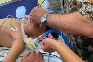 У Львові лікарі прооперували хлопчика, у якого рот відкривався лише на 0,5 см