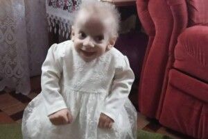 На Волині померла 8-річна дівчинка із хворобою передчасного старіння