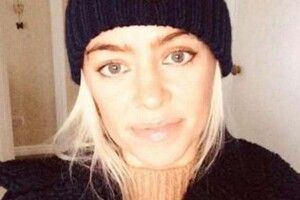 Очі налилися кров'ю, набрякла шия: пацієнтка розповіла про рідкісні симптоми COVID-19