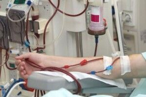 Чи буде відділення гемодіалізу у Любешівській лікарні
