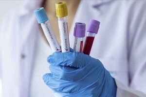 На Волині восьмеро людей заразилися коронавірусом: 5 – у Луцькому районі