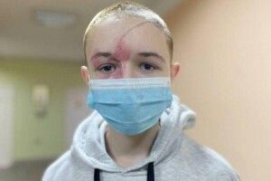 Ледь живого дістали з-під завалів: у Львові врятували життя підлітку після 9 днів в комі