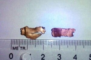  На Донеччині троє дітей підірвалися на вибуховому пристрої