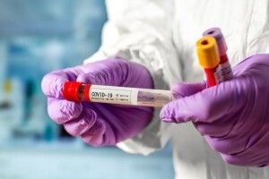 Від коронавірусу померли двоє волинян